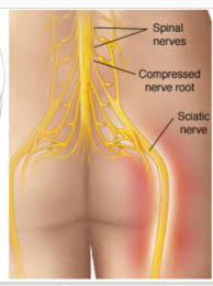 What causes back pain during pregnancy? Bum Pain 23 Weeks Babycenter