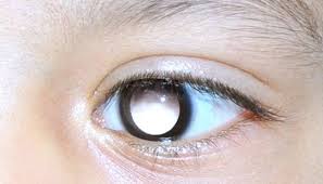 Any unusual lump or swelling. World Retinoblastoma Week Aims To Show Early Detection Of Childhood Eye Cancer Is Curable Ethical Marketing News