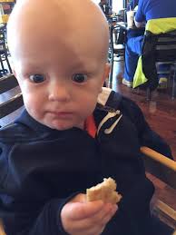 Anyone else have hoarse voice, since yesterday's bout of chem trails