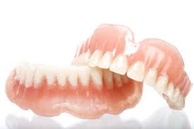 Synonyme sind coverdenture und deckprothese. Zahnersatz