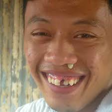 B u r i k a t m a n o y