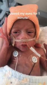 What Do Babies Born at 7 Months Look Like