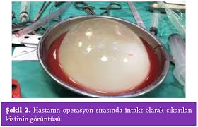 Turkiye Parazitoloji Dergisi