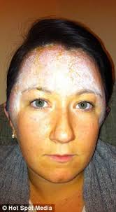 Instead, they show up the second, third or fourth time around, says dr. Mother Hospitalised For Three Days After Allergic Reaction To Hair Dye Almost Killed Her Daily Mail Online