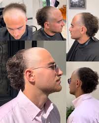 Debería estar prohibido en los gyms