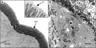 A microbial biorealm page on the genus salmonella typhimurium. Salmonella Enterica Serovar Typhimurium S Typhimurium Tml Invades Download Scientific Diagram