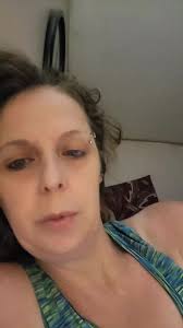 Singleton Merton Syndrome