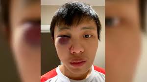 Inglaterra: “No quiero tu coronavirus en mi país”: joven asiático sufre  brutal golpiza en Londres