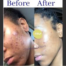 The bigger the hair....you know the rest 😌⠀ ⠀ One of our favorite looks  created by @blakejael using a FULL set of @melanjhair 18” Coil Curl clip  ins 😍😍⠀ ⠀ Shop Now,