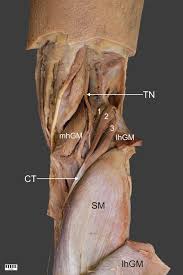Molly smith dipcnm, mbant • reviewer: A Three Headed Plantaris Muscle Evidence That The Plantaris Is Not A Vestigial Muscle Springerlink