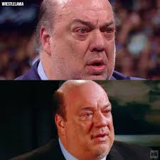 Paul Heyman said that in order to achieve his disheveled look he had:-