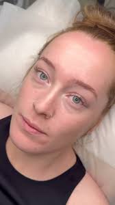 Beautiful face with beautiful brows 🤍 ANGEL FACE, • 𝗅𝗈𝗏𝖾 𝗆𝖾 𝖺  𝗀𝗈𝗈𝖽 𝖻𝖾𝖿𝗈𝗋𝖾 𝖺𝗇𝖽 𝖺𝖿𝗍𝖾𝗋🪩, •, •, • 𝖣𝚎𝚝𝚊𝚒𝚕𝚜:, •  𝖻𝗋𝗈𝗐 𝗅𝖺𝗆𝗂𝗇𝖺𝗍𝗂𝗈𝗇, •, •, •, • 𝖬𝖾𝗌𝗌𝖺𝗀𝖾 𝗆𝖾 𝗈𝗋  𝖼𝗅𝗂𝖼𝗄 𝗍𝗁𝖾 𝗅𝗂𝗇𝗄 𝗂𝗇 𝗆𝗒 𝖻𝗂𝗈🤍, •, 📍Based at Darwin, ...