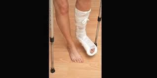 KOL VE BACAK YARALANMALARI ile ilgili gÃ¶rsel sonucu