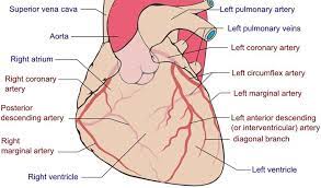 The first diagonal branch (d1) of the lad, the obtuse marginal branch (om) of the lcx, or the ramus intermedius. Coronary Artery Angiography Wfsa Resources