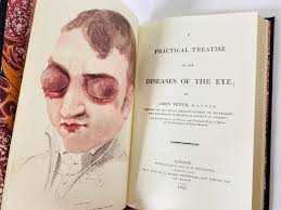 Diseases of the Eye Vintage Leather Medical Book by John Vetch Surgery  Medicine Physician Doctor Practical Treastise