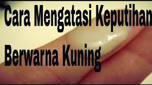 Check spelling or type a new query. Cara Mengatasi Keputihan Berwarna Kuning Youtube