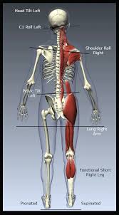 Pin On Scoliosis
