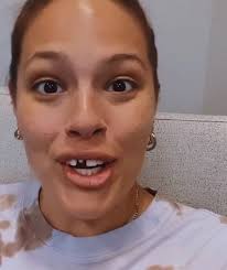 Ashley Graham Shows Off Broken Tooth After Frozen Cookie Mishap