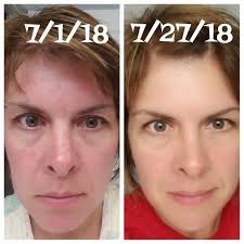 Looking for #killerskin