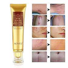 Tcm Acne Scar Cream Mrtopbuy Com Acne Mark Removal Acne Scar Removal Acne Marks