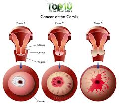 Pin On Cervical Mucus
