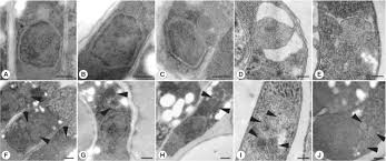 The oocyst is resistant to conventional chemical disinfectants that are commonly used in water treatment such as chlorine or chloramines. Sciencecentral