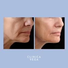 Clínica Vega