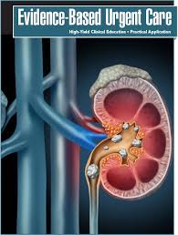 Image result for Nephrolithiasis