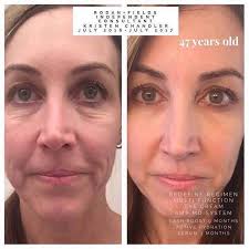 Rodan + Fields Consultant Heather DiRienzo