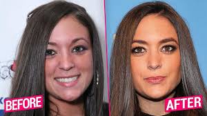 We talk to a woman who had a nose job to find out what it's really like to get plastic surgery. Jersey Shore Cast S Shocking Plastic Surgery Transformations Revealed