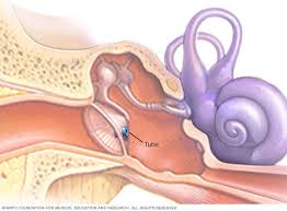 If you're not feeling well, skip the waiting there isn't a definite answer as to how long it takes antibiotics to work, but most of these drugs typically begin to work immediately if taken properly. Ear Infection Middle Ear Diagnosis And Treatment Mayo Clinic