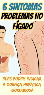 com o corpo sobrecarregado um dos principais afetados e o figado que acaba por acumular celulas de gordura veja natural medicine health health and nutrition