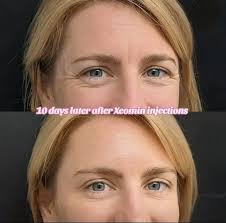 🌟 Meet Katrina Gustafson! 🌟 We are thrilled to introduce the newest  member of the Robert Andrews family, Katrina Gustafson! 🎉 Katrina is a  board-certified nurse practitioner with a doctorate in nursing