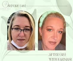 🖤 CUSTOMER RESULTS 🖤 Farmasi products used: Our burn and balance bundle  plus aloe glow… Plus 2 litres of water a day. Daily activities consisted of  dog walks chasing and feral toddlers