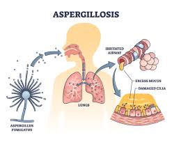Image result for Asparagus aspergillus