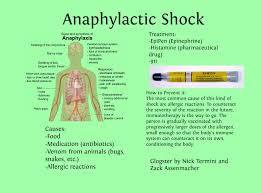 Anaphylactic Shock Emergency Nursing Critical Care Nursing Nursing Mnemonics