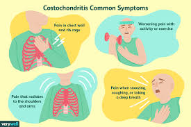 Ribs front and back vectors (28). Costochondritis Chest Pain In Fibromyalgia