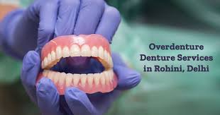 We did not find results for: Overdenture Implant Overdenture Premium Quality Overdenture Shanti Dentals