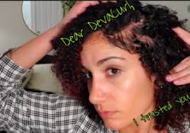 Hairstyle for balding crown for women with thin curly hair are popular today. Let S Talk About Hair Loss Alopecia Luxju Natural Hair Products