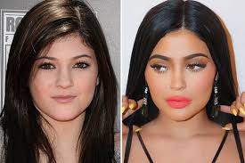 Raymond liotta, like most celebrities nursed the fear of ageing, growing old and its effect on the looks , he quickly opted for cosmetic surgery to reverse the . Is That Ray Liotta What The Hell Happened To His Face Star Sparks Surgery Rumours Daily Star