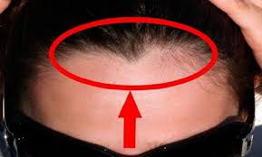 Saiba O Que E Bico De Viuva E Descubra Se Voce Tambem Tem Um Segredos Do Mundo Entre os cortes de cabelo masculino em alta para a temporada de calor estão muitos modelos curtos, desde. saiba o que e bico de viuva e descubra