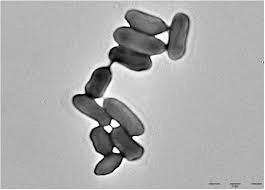 May 27, 2021 · ワクチン接種者の母乳中の抗体 3ヶ月前; Genomic Analysis Of A Raoultella Ornithinolytica Strain Causing Prosthetic Joint Infection In An Immunocompetent Patient Scientific Reports