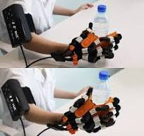 Stroke Rehab Equipment Hand Finger Exercise Recovery Assistive Glove for  Stroke