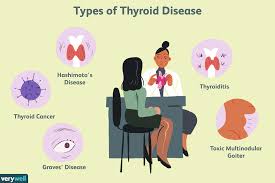 Living an active life is important to staying healthy. Thyroid Disease Causes And Risk Factors