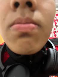 Dermatologist for my 14 year old son. Thank you.