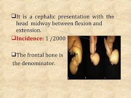 Image result for Shoulder Presentation