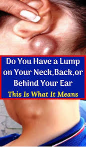 What causes a lump in your neck. Do You Have A Lump On Your Neck Back Or Behind Your Ear This Is What It Means Painful Acne Skin Bumps Muscle Knots