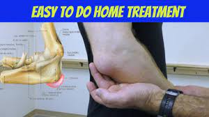 Elbow bursitis is inflammation of the bursa in your elbow. Elbow Bursitis Treatment At Home How To Treat Olecranon Bursitis Youtube