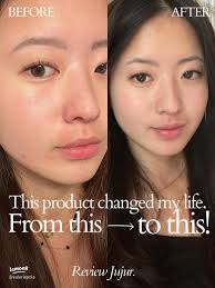 Mengapa Pyunkang Yul Calming Set Cocok untuk Kulit Sensitif dan Berjerawat? 