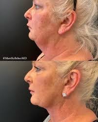 Caryn Roberts's Instagram, Twitter & Facebook